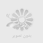ایمپلنت Snucone | همه چیز درباره ویژگی‌ها و مراحل کاشت